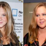 Amy Schumer's Plastic Surgery