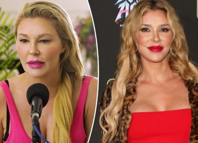 Brandi Glanville's Bad Plastic Surgery 2024