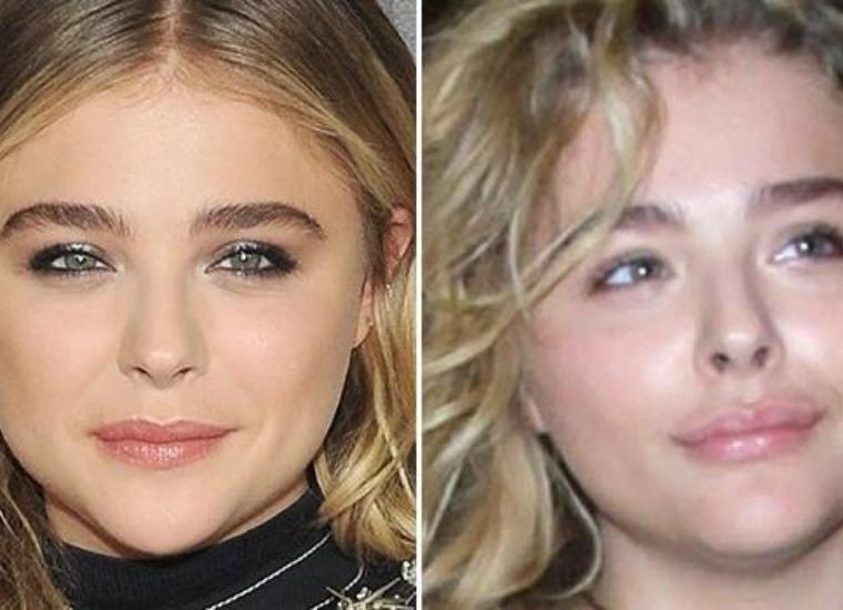 Chloe Grace Moretz felt pressured to get breast implants