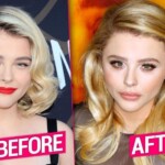 Chloe Grace Moretz Plastic Surgery 2024