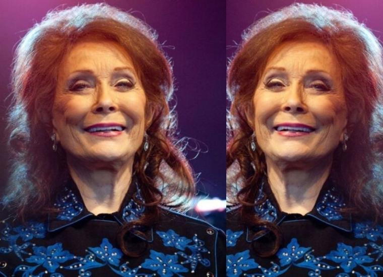 Did Loretta Lynn Get Plastic Surgery?