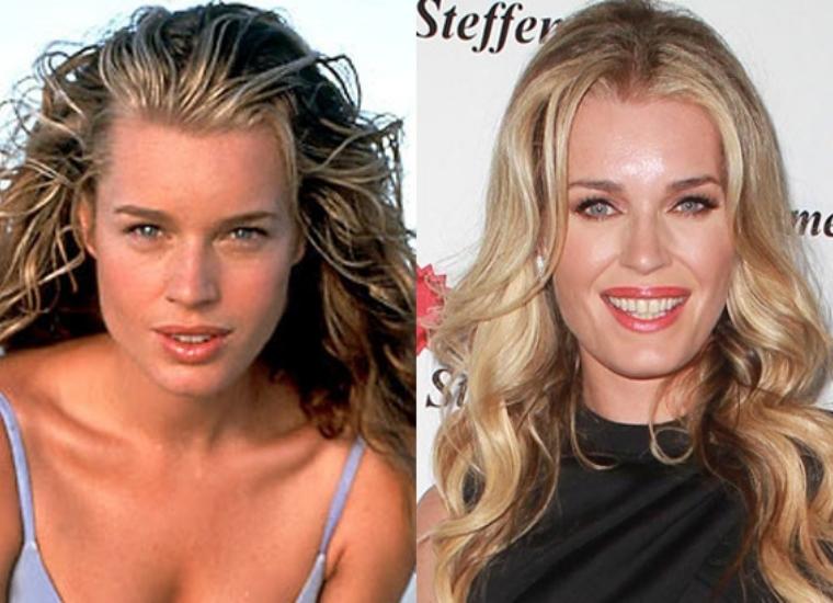 Has Rebecca Romijn Undergone Plastic Surgery?