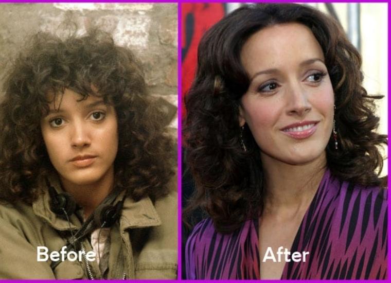 Jennifer Beals Botox Injection