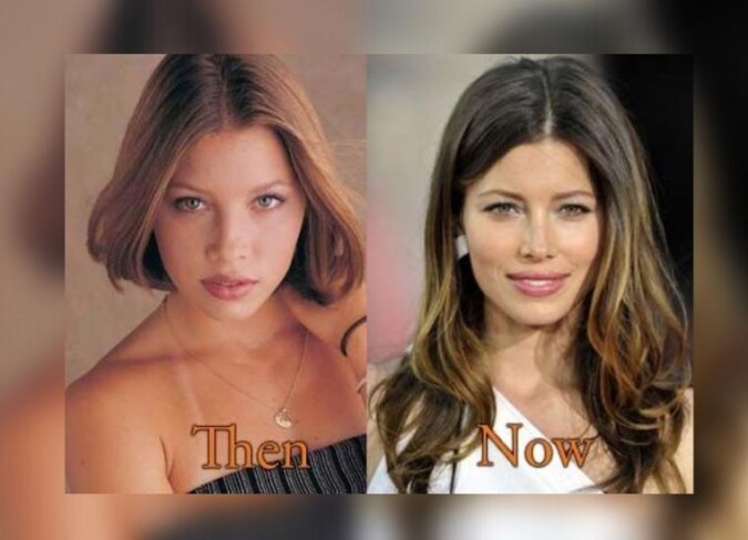 Jessica Biel Plastic Surgery