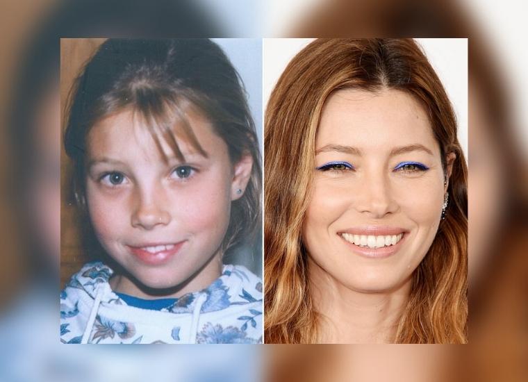 Jessica Biel's Plastic Surgery