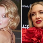 Kate Hudson's Plastic Surgery