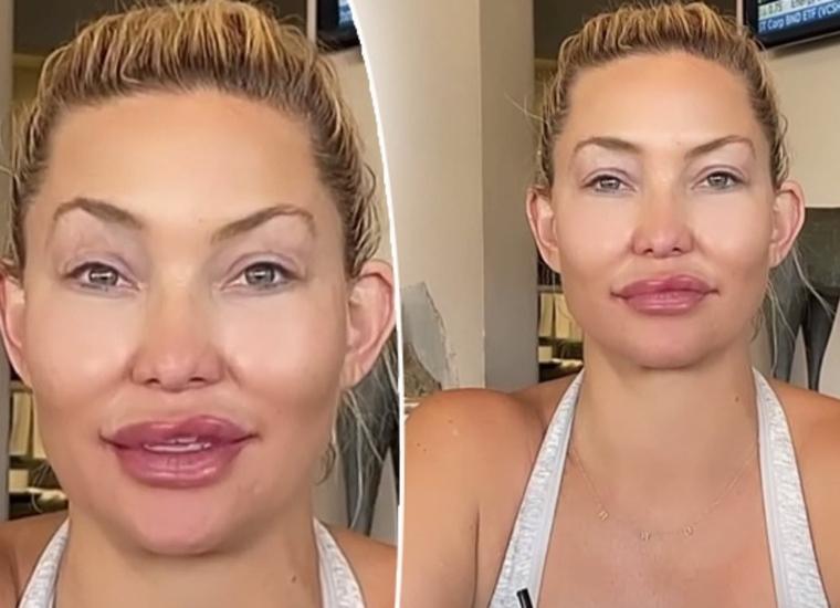 Kate Hudson's Plastic Surgery Experience