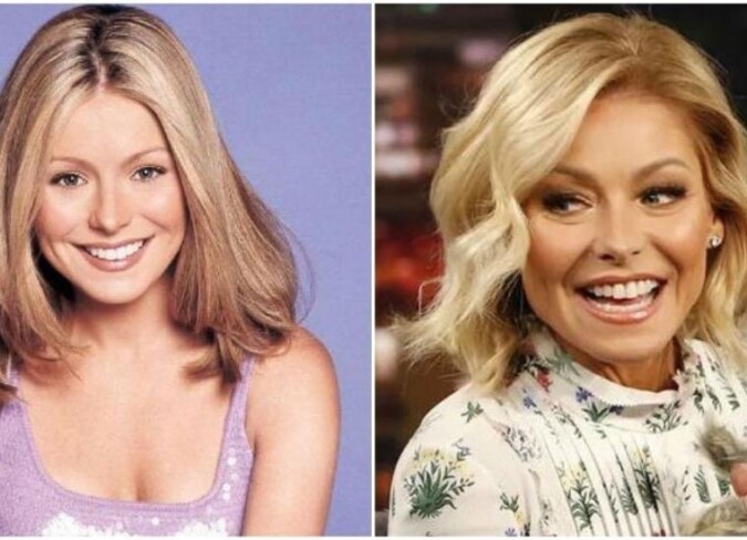 Kelly Ripa Discusses Plastic Surgery