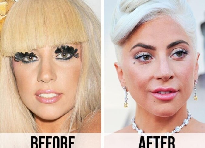 Lady Gaga Plastic Surgery