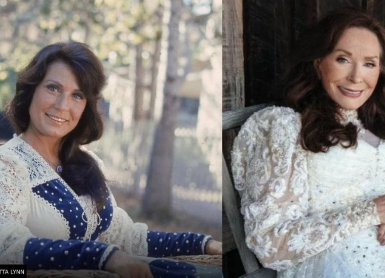 Loretta Lynn Plastic Surgery Before and After