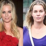 Rebecca Romijn Plastic Surgery