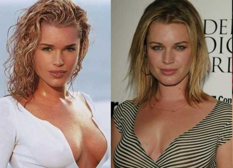 Rebecca Romijn Stamos, Is Said to Have Undergone Plastic Surgery 