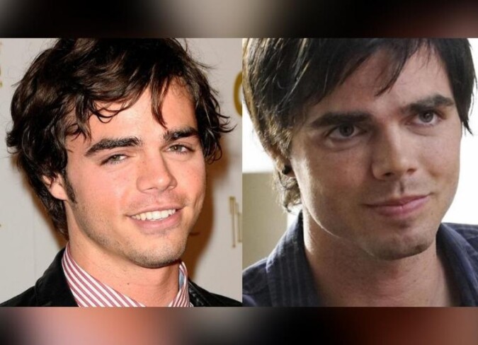 Reid Ewing Plastic Surgery 2024