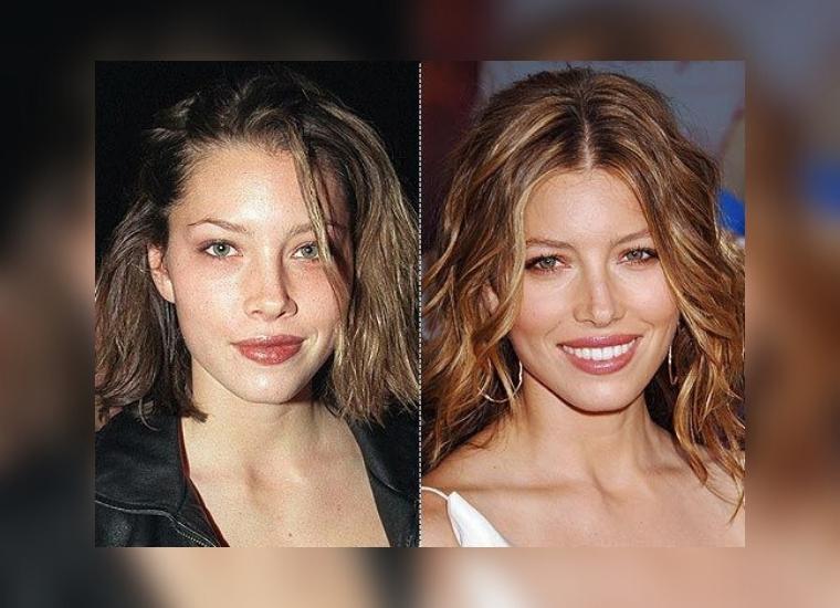 Jessica Biel Plastic Surgery Is The Sinner Actress Getting A Nose Job 