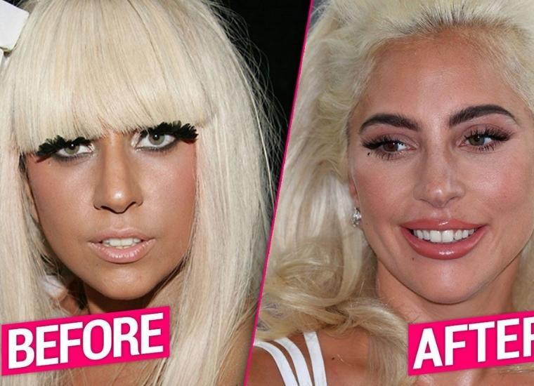 What Has Changed About Gaga's Face?