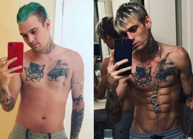 Aaron Carter's Weight Loss