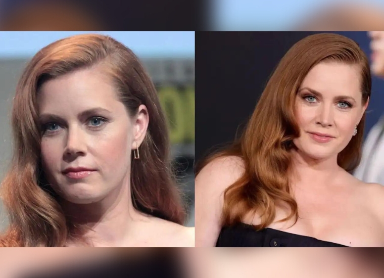 Amy Adams Plastic Surgery