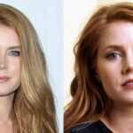 Amy Adams' Plastic Surgery