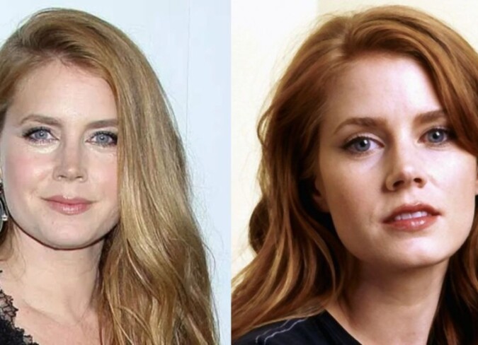 Amy Adams' Plastic Surgery