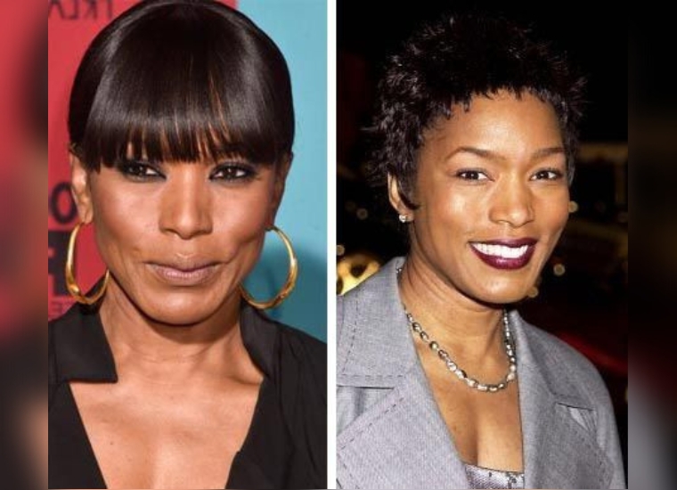 Angela Bassett's Plastic Surgery in 2024