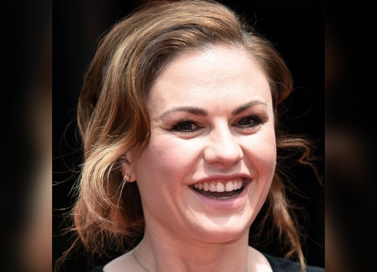 Anna Paquin Teeth Gap: What Does Actress Think About It?