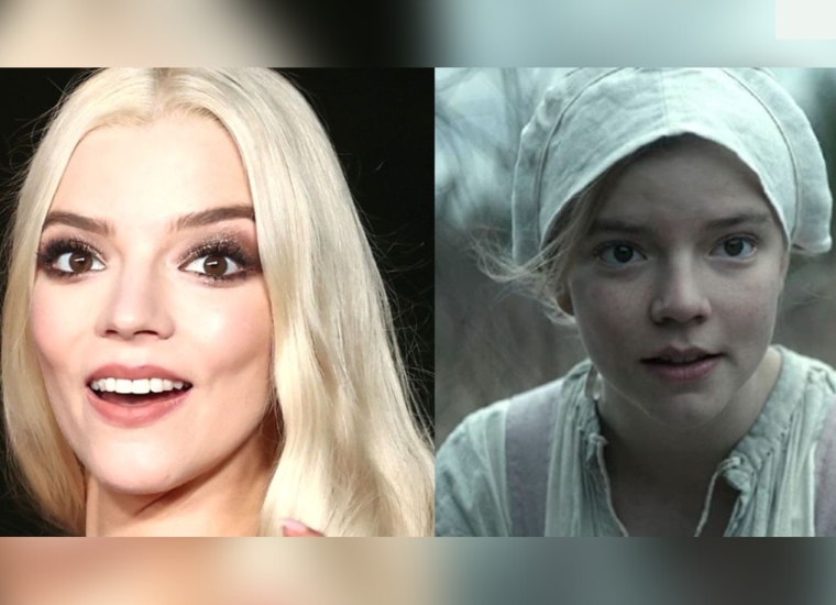 Anya Taylor-Joy Plastic Surgery 2024