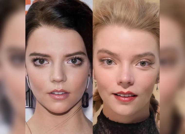 Anya Taylor-Joy's Plastic Surgery 2024