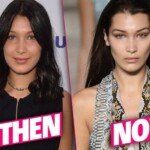 Bella Hadid's Plastic Surgery