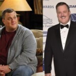 Billy Gardell Weight Loss Surgery