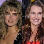 Brooke Shields' Plastic Surgery