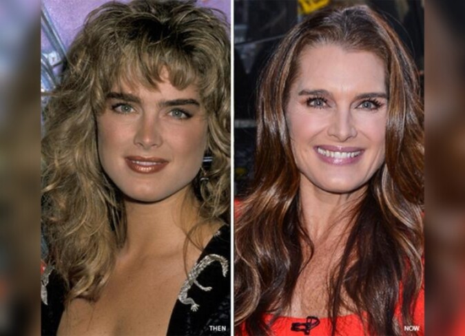 Brooke Shields' Plastic Surgery