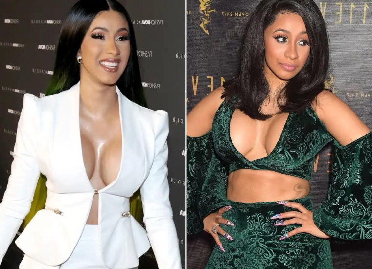 Cardi B Before Plastic Surgery: The Rapper Claims To Be Happier