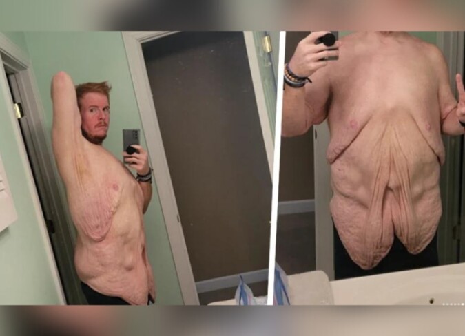 Casey King Weight Loss