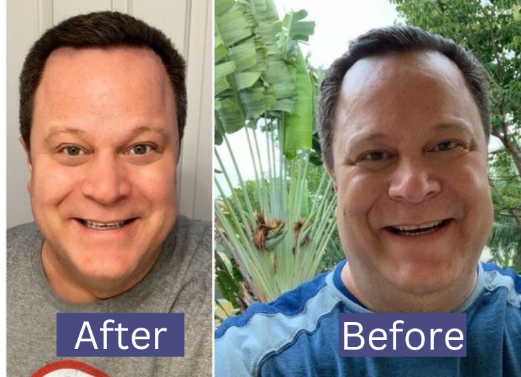 David Venable Weight Loss