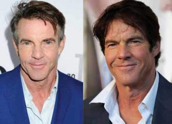 Dennis Quaid