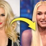 Gwen Stefani Plastic Surgery Interview