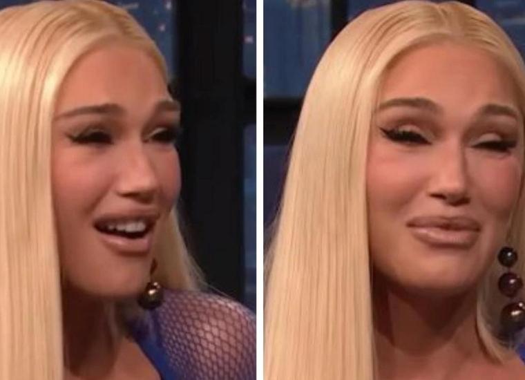 Gwen Stefani's Plastic Surgery Interview