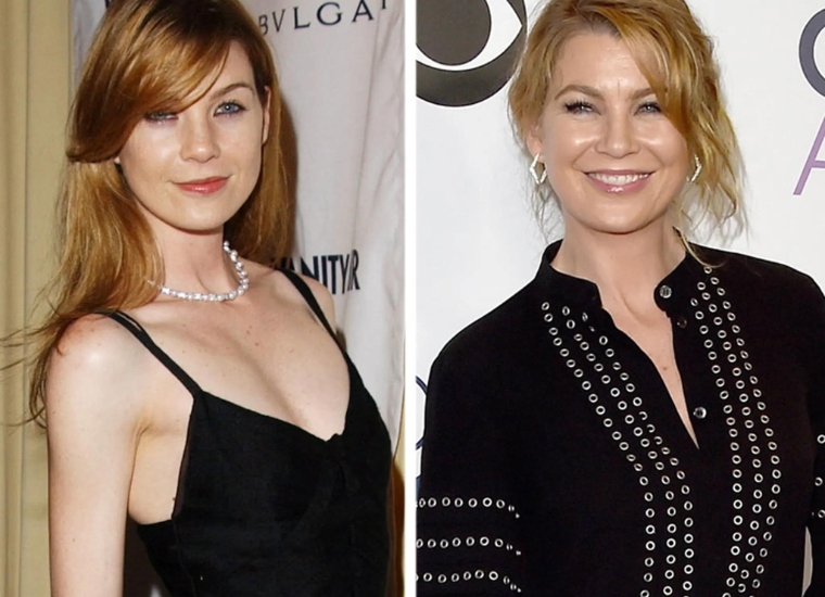 Has Ellen Pompeo Done Plastic Surgery?