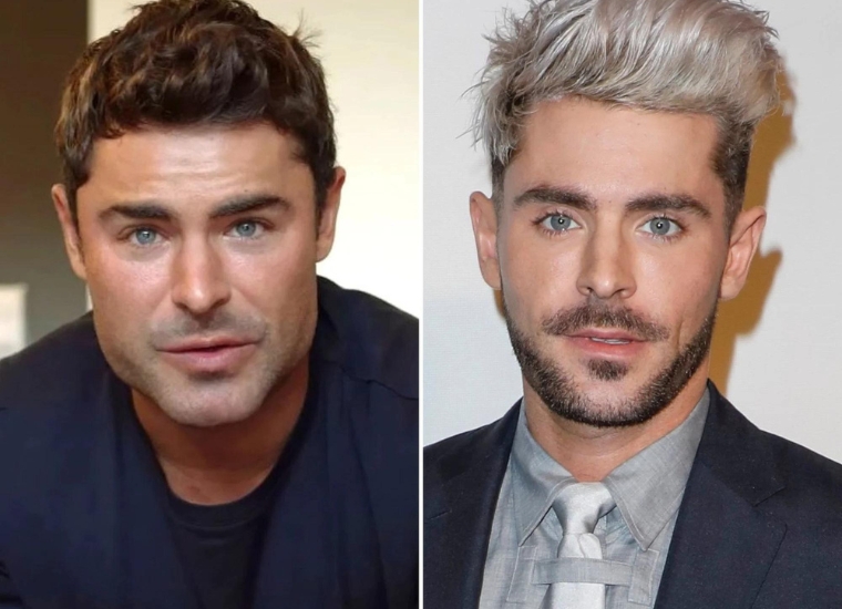 Has Zac Efron Undergone Plastic Surgery?