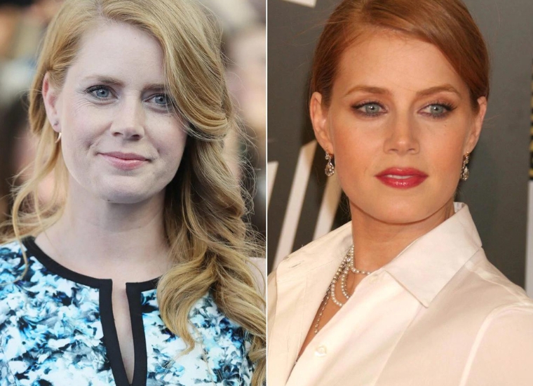 How is Amy Adams' Nose Job?