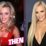 Jenny McCarthy Plastic Surgery