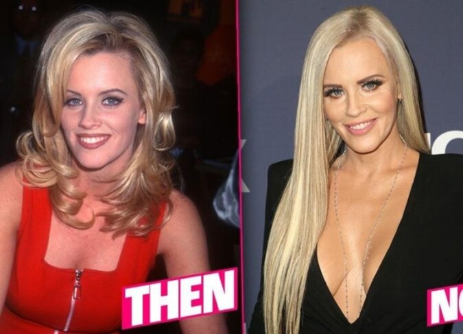 Jenny McCarthy Plastic Surgery