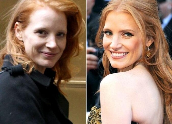 Jessica Chastain's Plastic Surgery