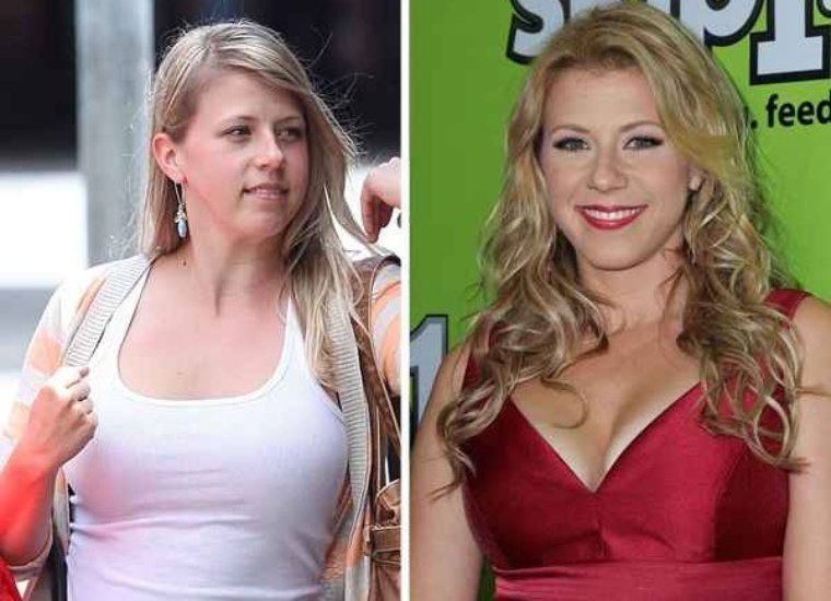 Jodie Sweetin's Plastic Surgery 2024