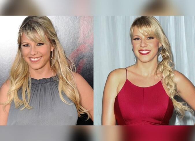 Jodie Sweetin's Plastic Surgery