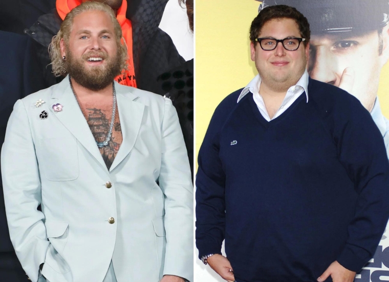 Jonah Hill Weight Loss Surgery 2024