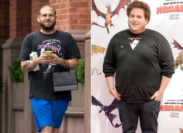 Jonah Hill Weight Loss Surgery