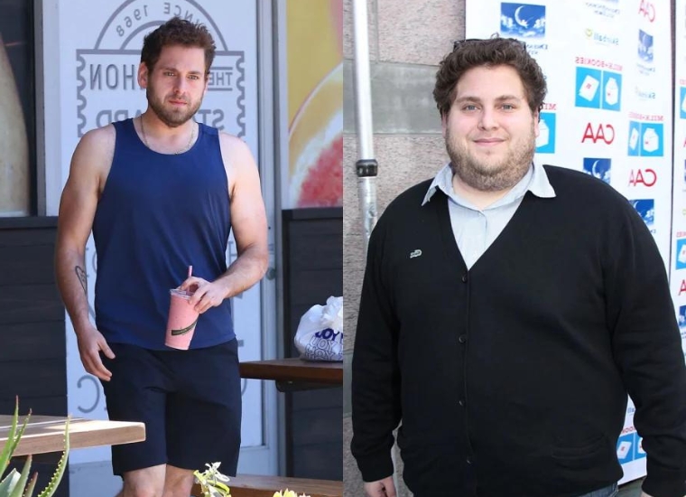 Jonah Hill's Weight Loss Surgery 2024