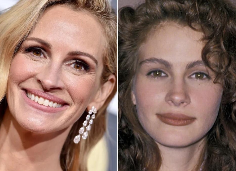 Julia Roberts Plastic Surgery 2024