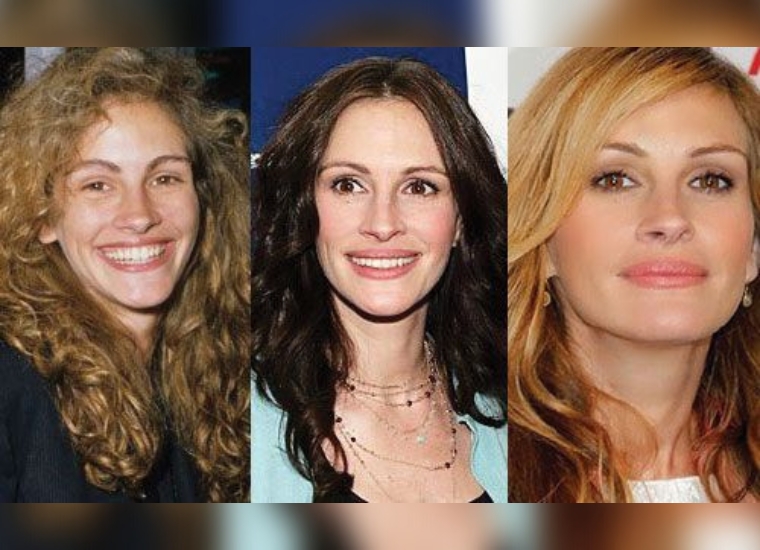 Julia Roberts' Plastic Surgery 2024